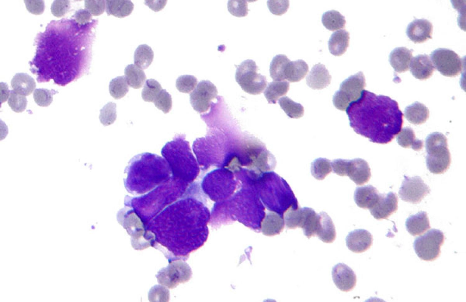 Cancer cells