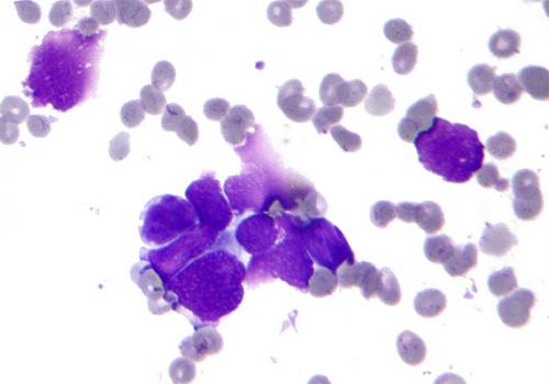 Cancer cells