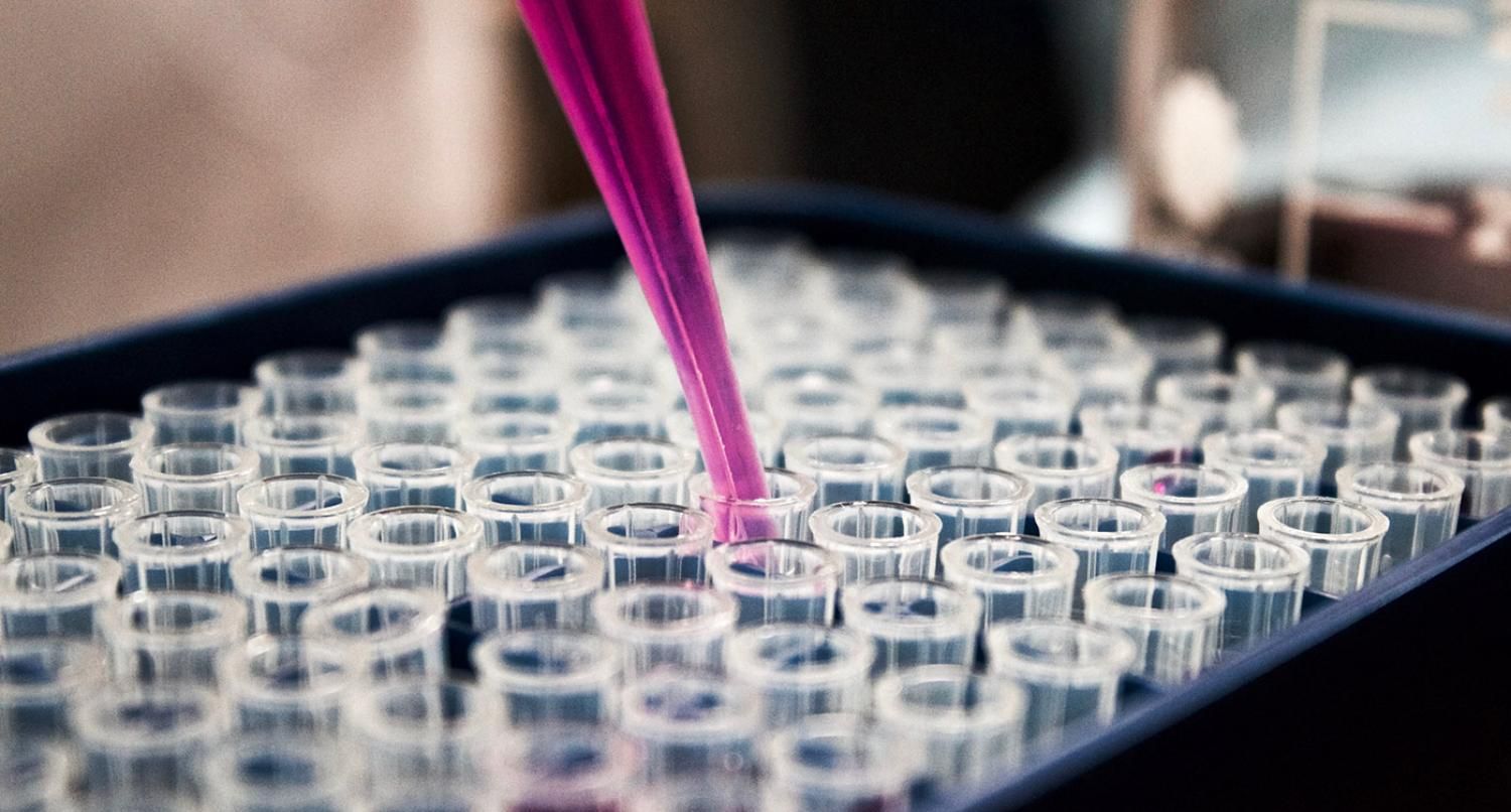 Lab test