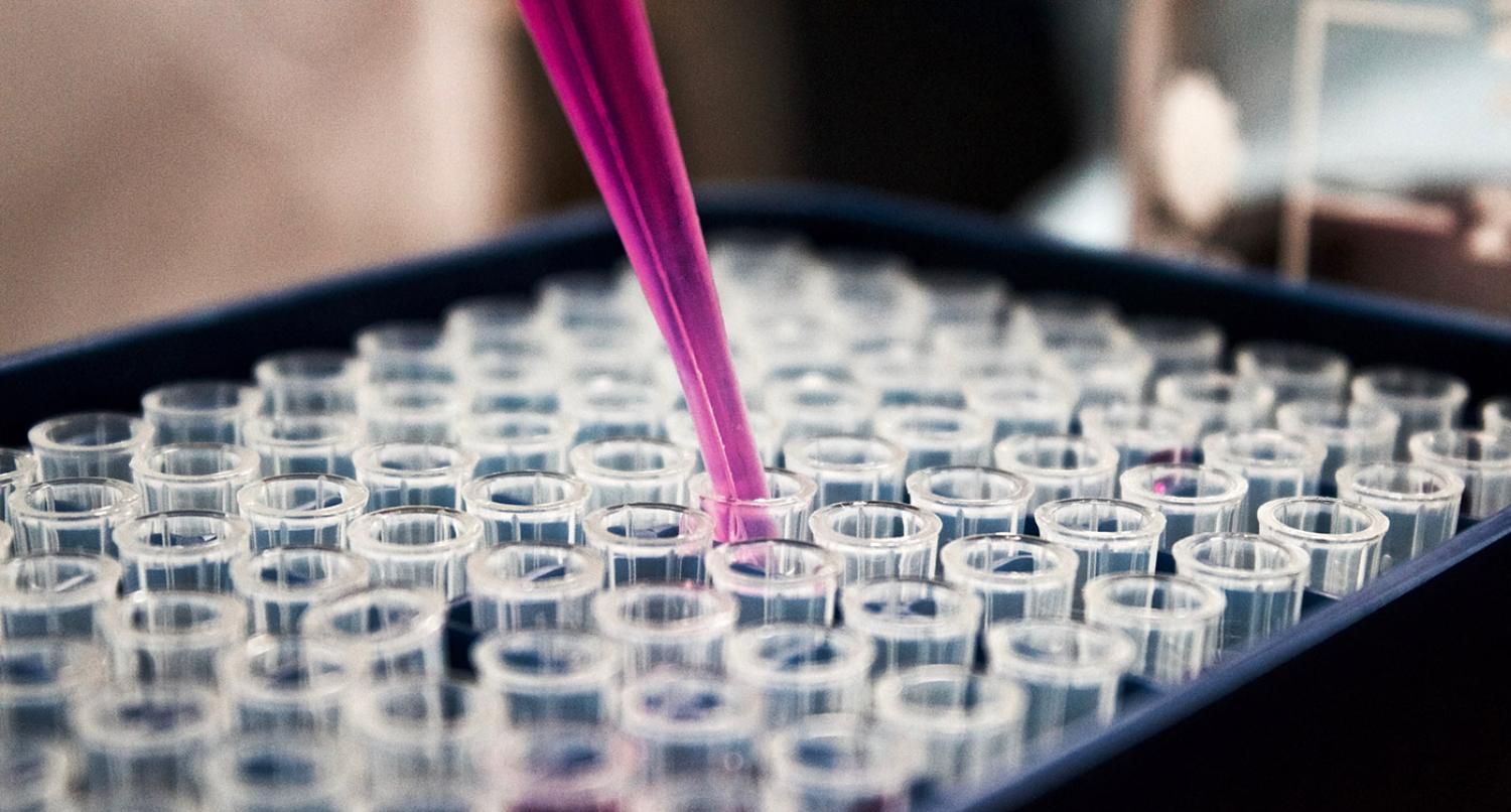Lab test